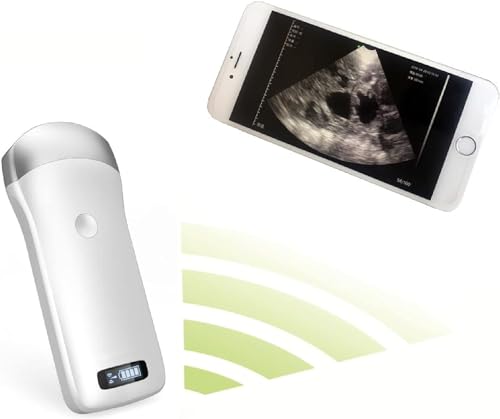 Escáner de ultrasonido inalámbrico portátil, sonda de instrumento de diagnóstico de embarazo veterinario, teléfonos inteligentes...